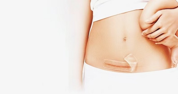 چرا ورق های اسکار ژل سیلیکونی ضخیم اینقدر محبوب هستند؟